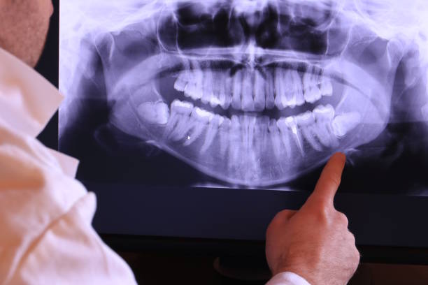 Best Emergency Treatment for Dental Infections or Abscesses in Cienega Springs, AZ