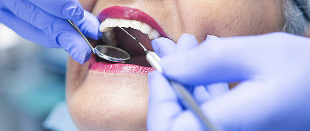 Best Emergency Dental Care for Broken or Chipped Teeth in Cienega Springs, AZ